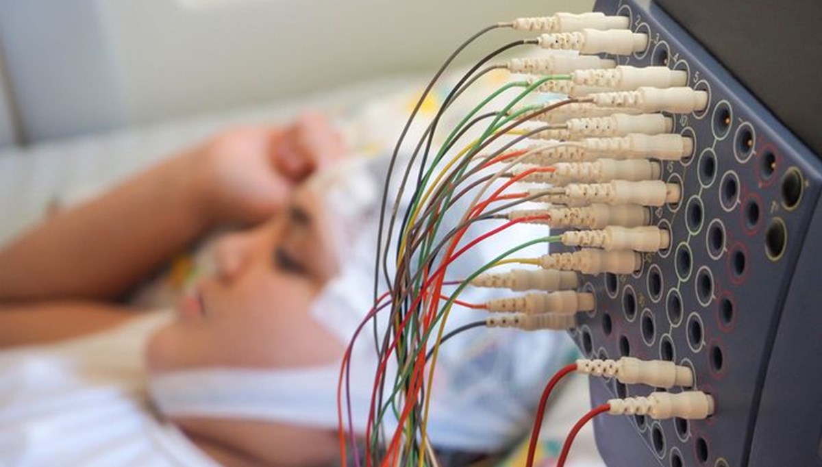 Tıp tarihinde bir ilk! Epilepsi hastası çocuk kafasına yerleştirilen cihazla iyileşti