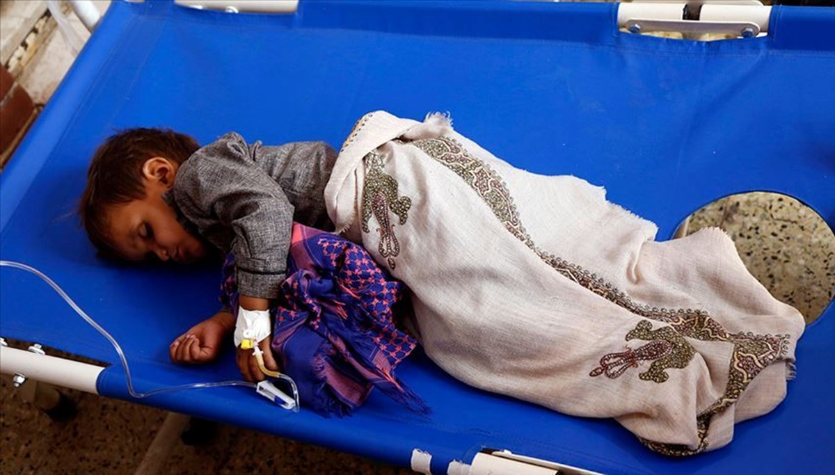 Yemen'de 6 ayda 63 bin kolera vakası görüldü